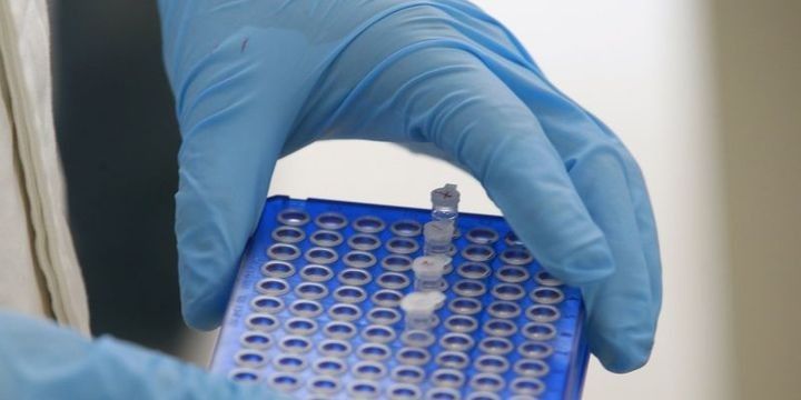 Yaponiya şirkətinin səhmləri "kəşf"dən sonra kəskin bahalaşıb